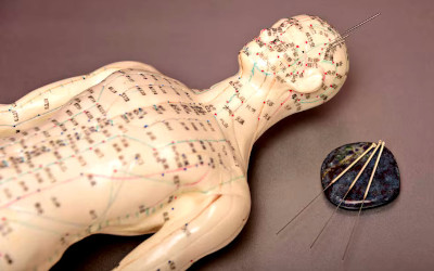 acupuncture, traditional Chinese medicine