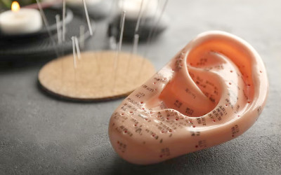 auricular therapy